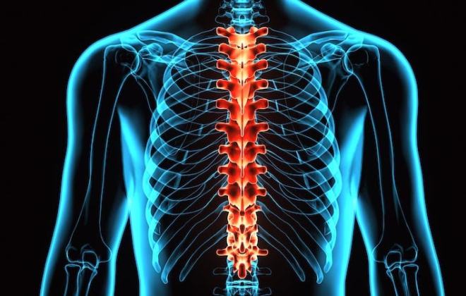 Spinal Cord Injury